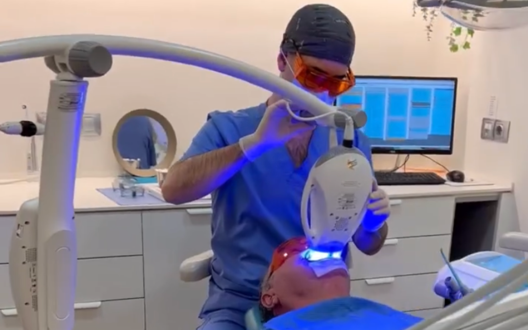 4 consejos para mantener tu blanqueamiento dental